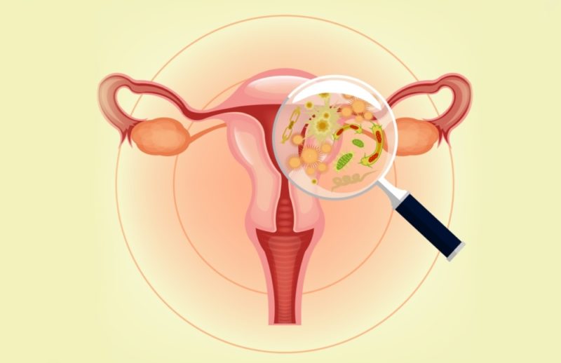 Дисбиоз влагалища: симптомы, диагностика и лечение бактериального вагиноза