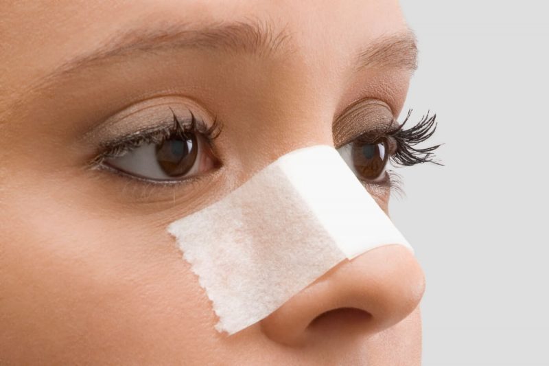 Искривление носовой перегородки: причины, симптомы, последствия, лечение