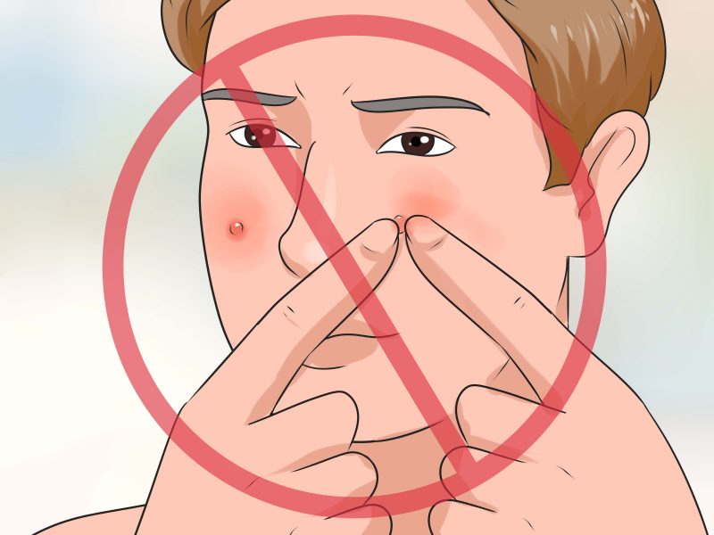 Фурункул на лице: как лечить, причины и симптомы фурункулеза на лице