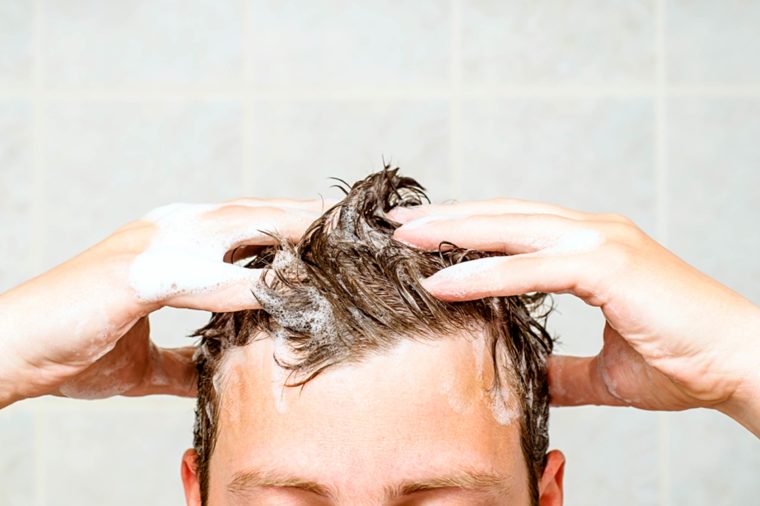 Псориаз на голове: симптомы и лечение, препараты и народные средства от псориаза волосистой части головы