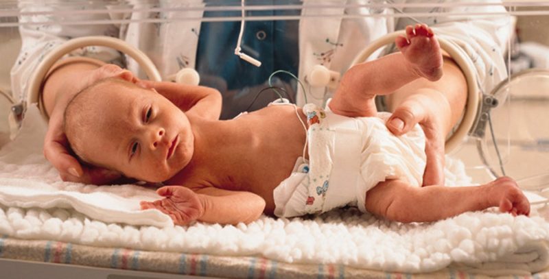 Перинатальное поражение ЦНС: причины, симптомы и последствия ППЦНС у новорожденных детей