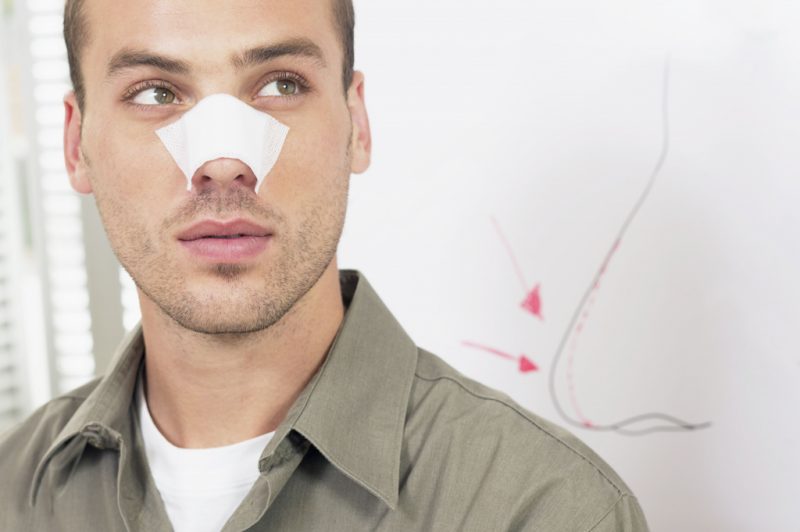 Искривление носовой перегородки: причины, симптомы, последствия, лечение