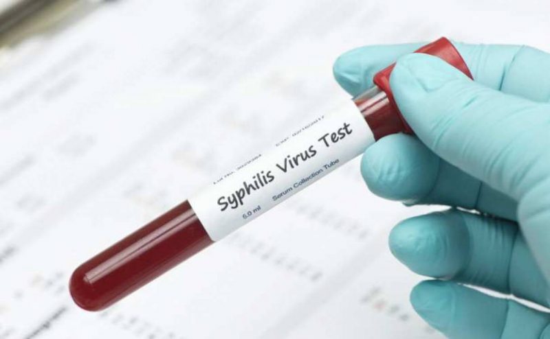 Бытовой сифилис – как передается и как проявляется? Бытовой путь заражения сифилисом, признаки и симптомы
