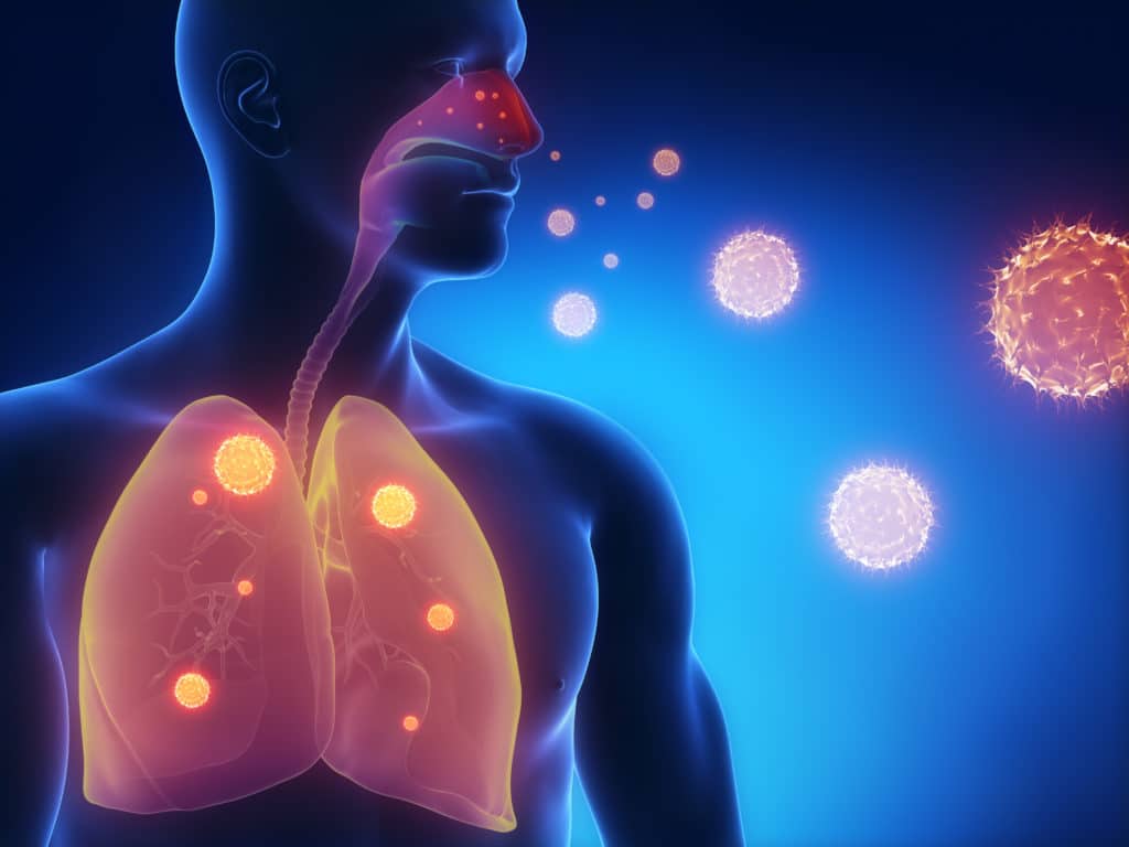 Как передается пневмония от человека к человеку, заразно ли воспаление легких, симптомы заболевания
