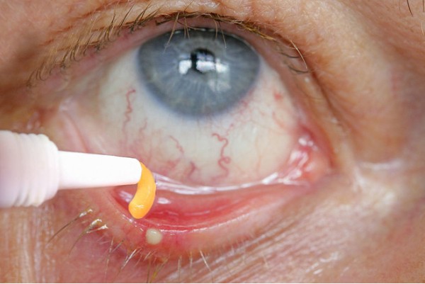 Мазь Флоксал: инструкция по применению глазной мази с антибиотиком, состав, аналоги